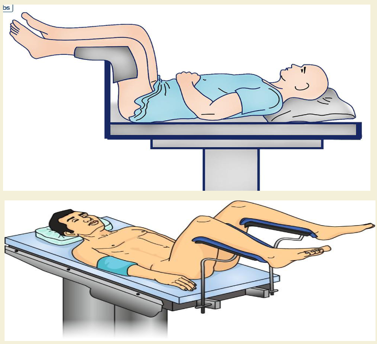 <p>Lithotomy</p>