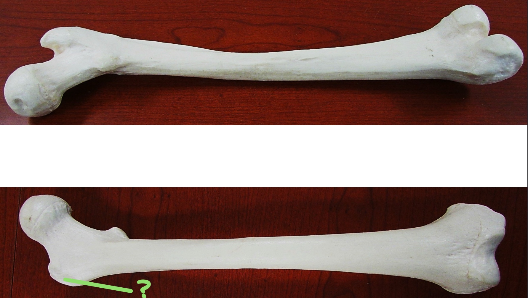 <p>Determine the part of the Femur highlighted</p>
