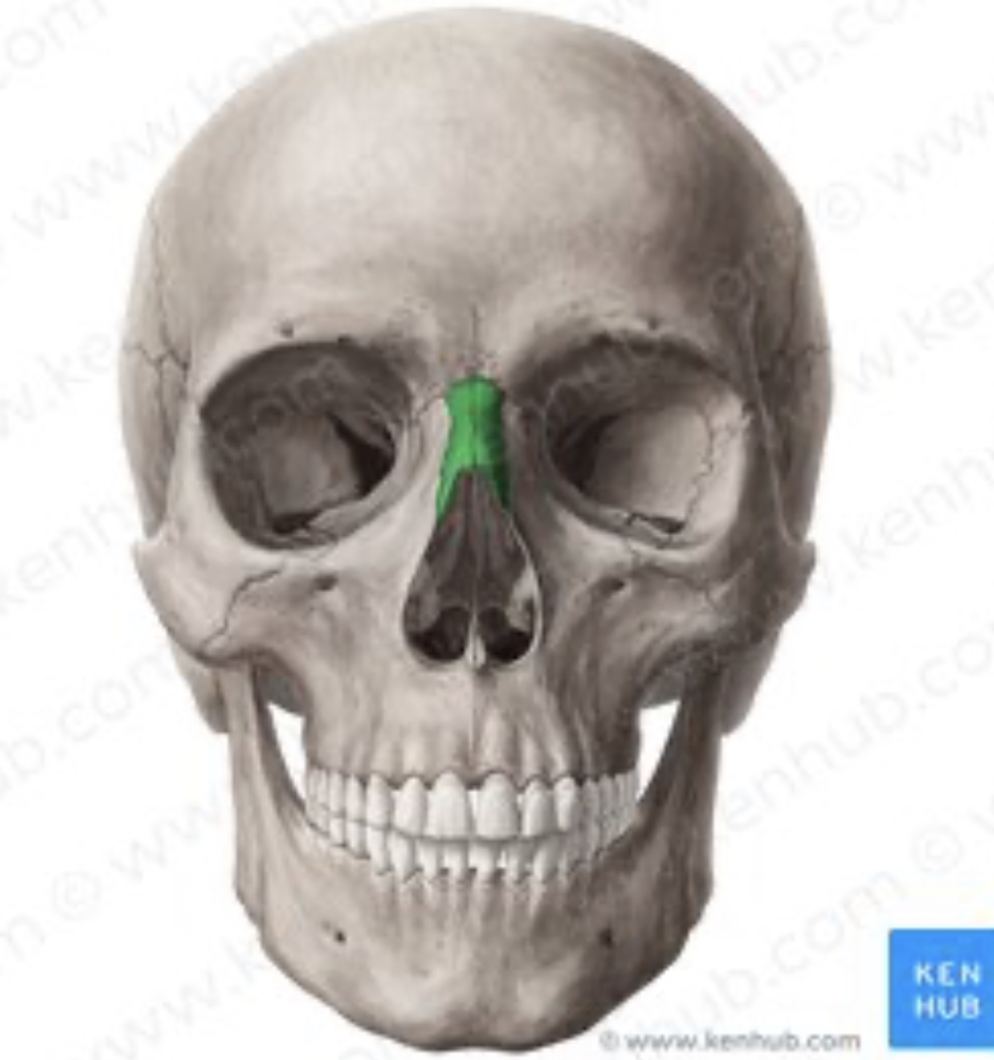 <p>Name this bone:</p>