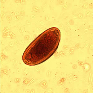 <p>Enterobius vermicularis</p>