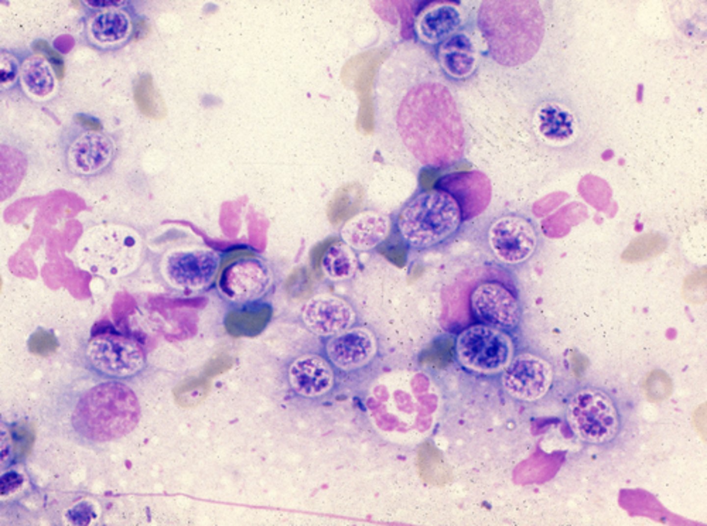 <p>Non-photosynthetic algae, infects skin and subcutaneous in humans.</p>