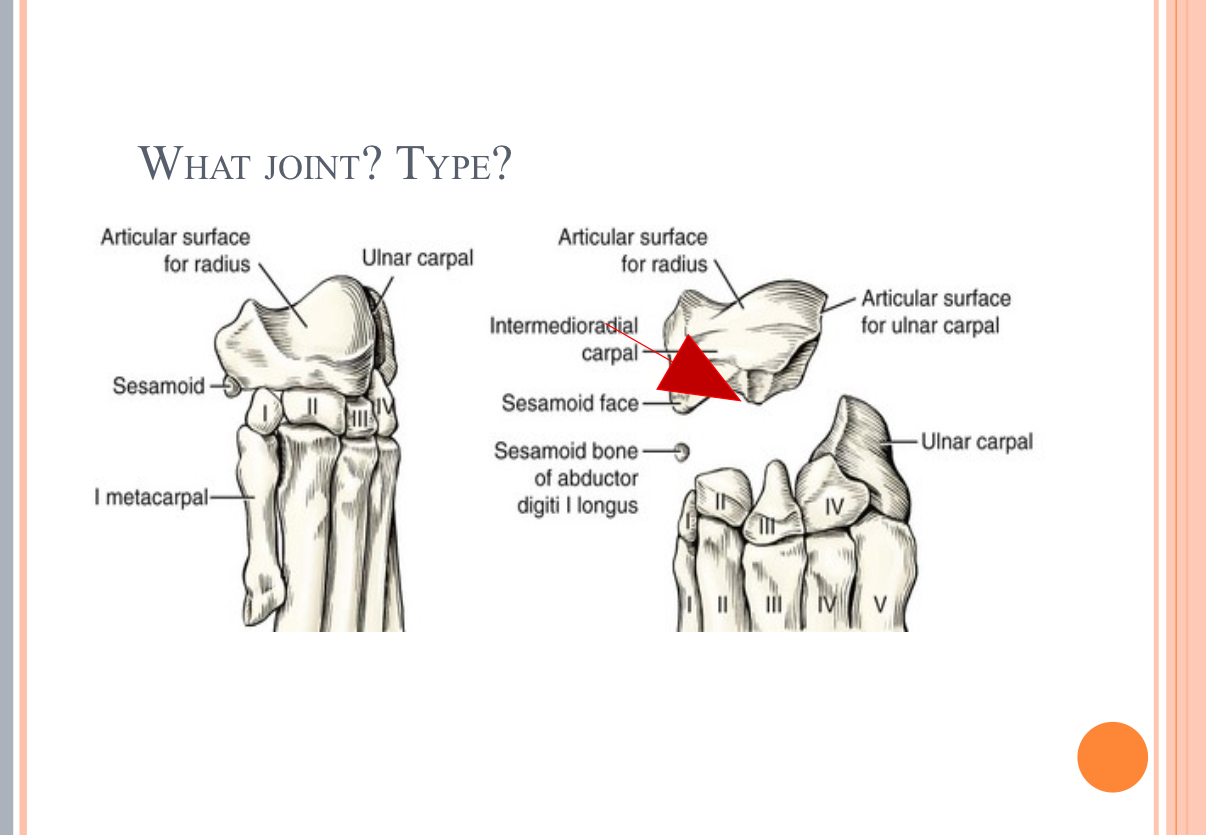 <p>What Type of Joint?</p>