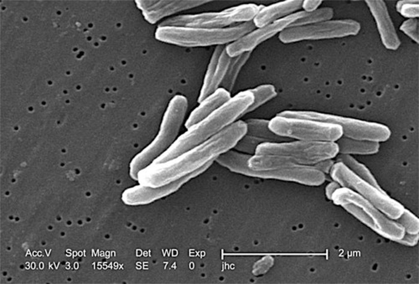 <p>A highly evolved pathogenic bacteria that infects the lungs of mammals.</p>