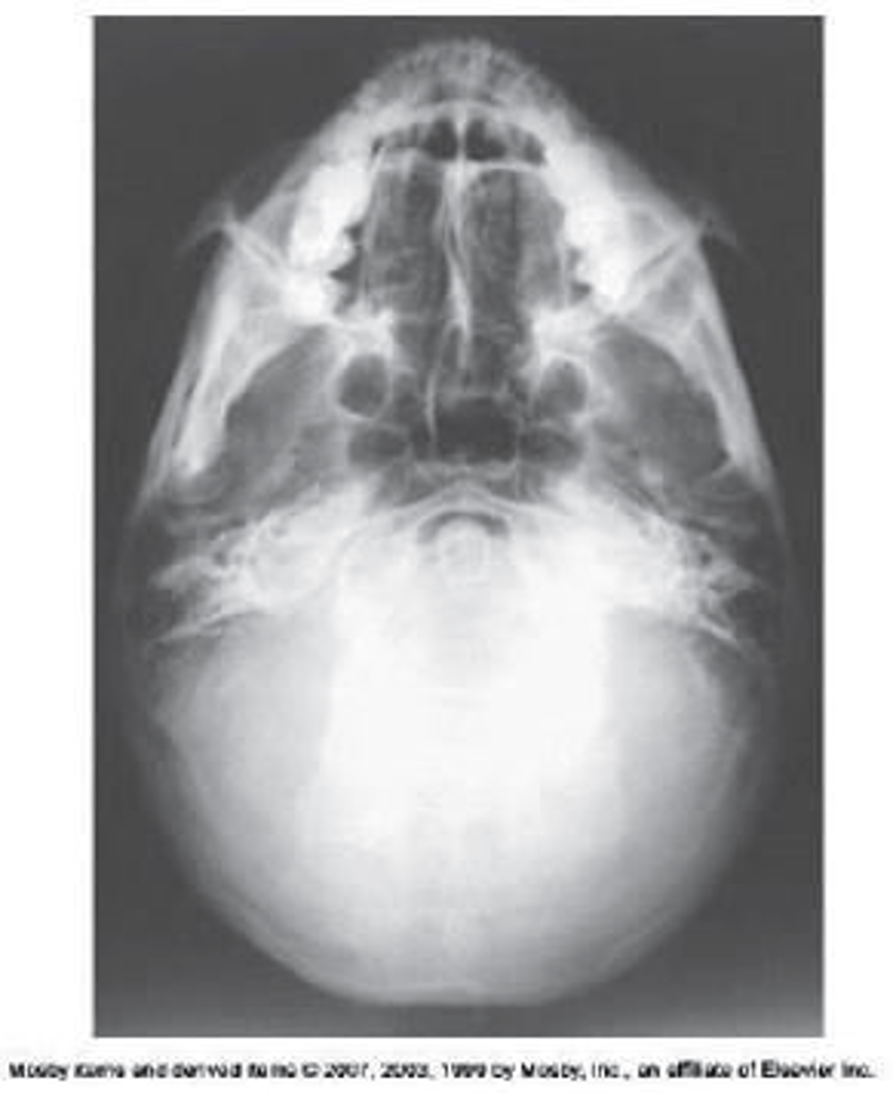 <p>d. SMV (Shüller)</p>