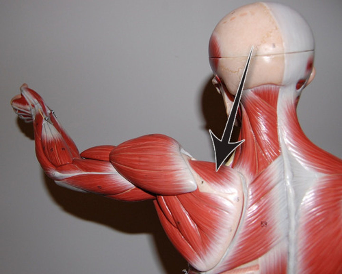 <p>Cadaver/Prone</p><p>Location: between the deltoid and the neck, top of the scapula</p><p>Muscle actions: abduct the arm</p>
