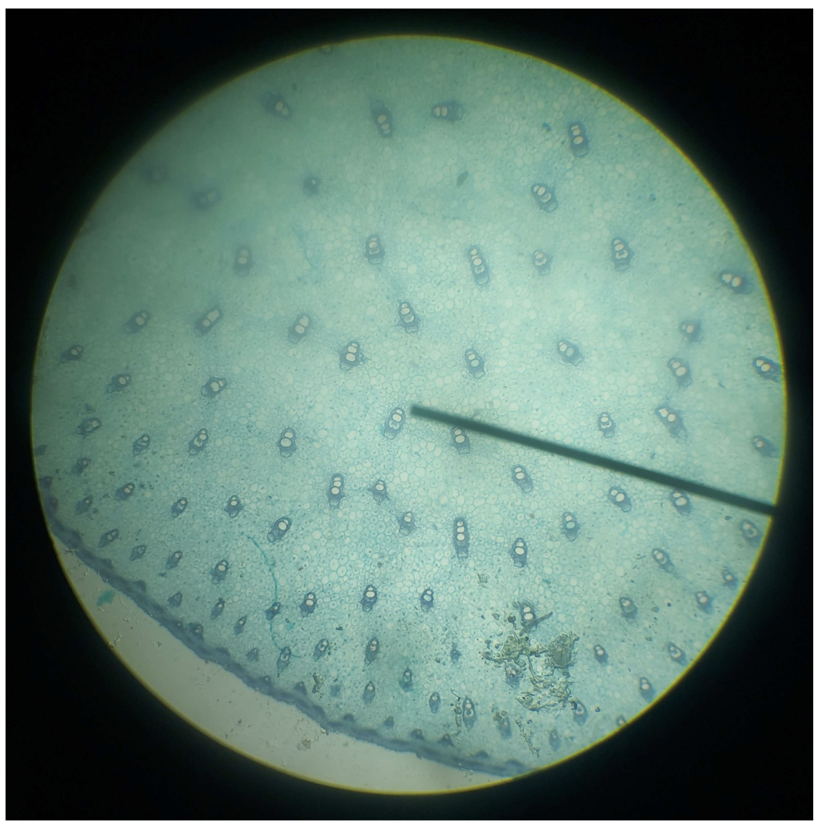 <p>Vascular Bundle</p>