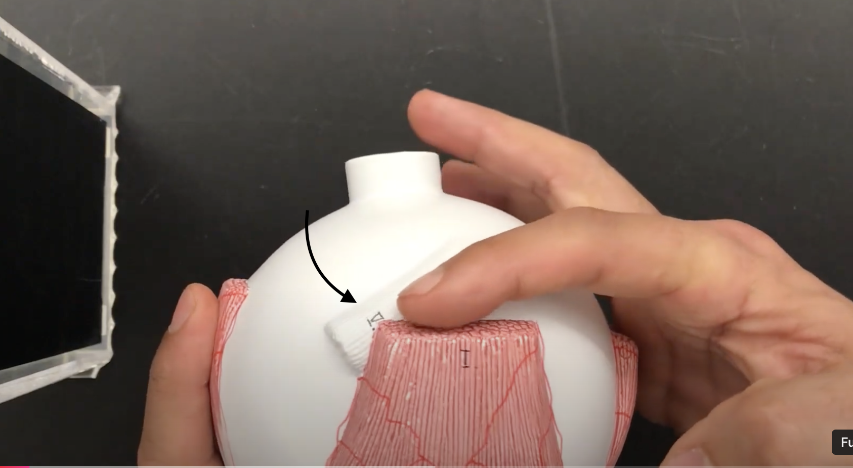 <p>What muscle is this?*****</p>
