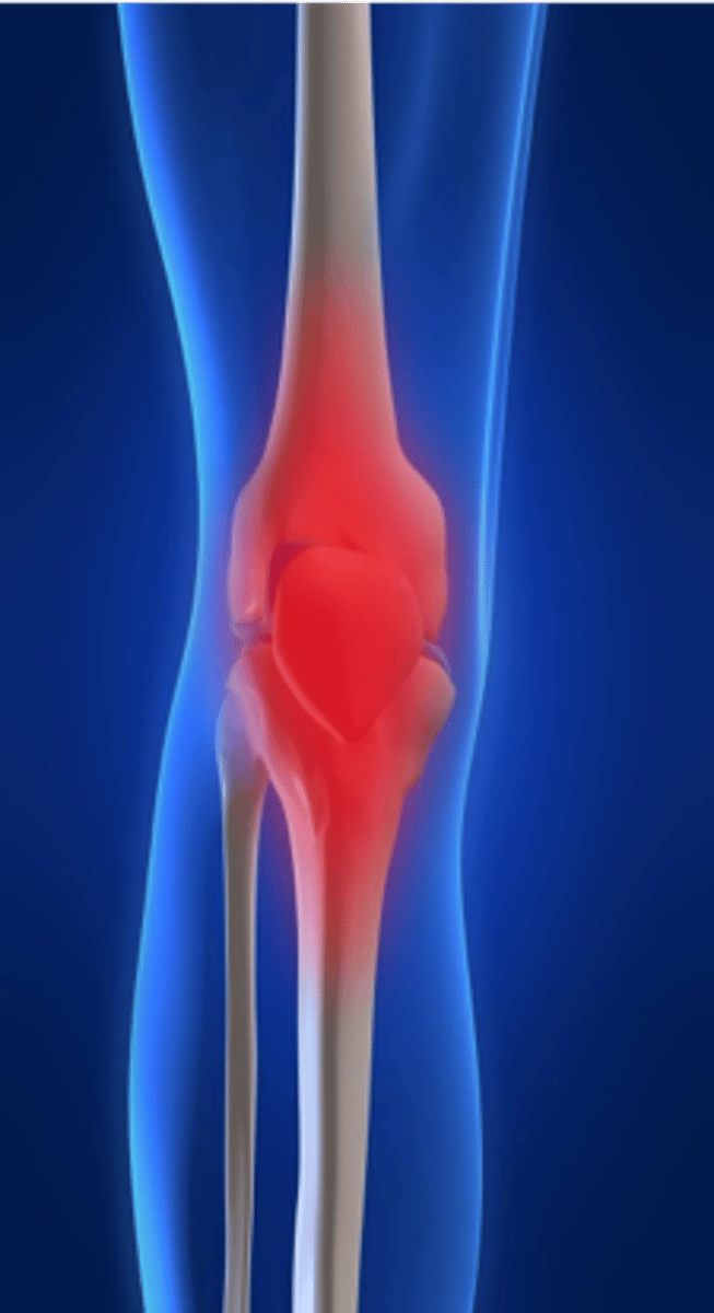 <p>originating from muscle, bone, joints, tendons, or blood vessels</p>