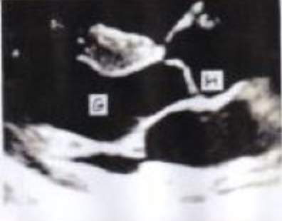 <p>G?</p>