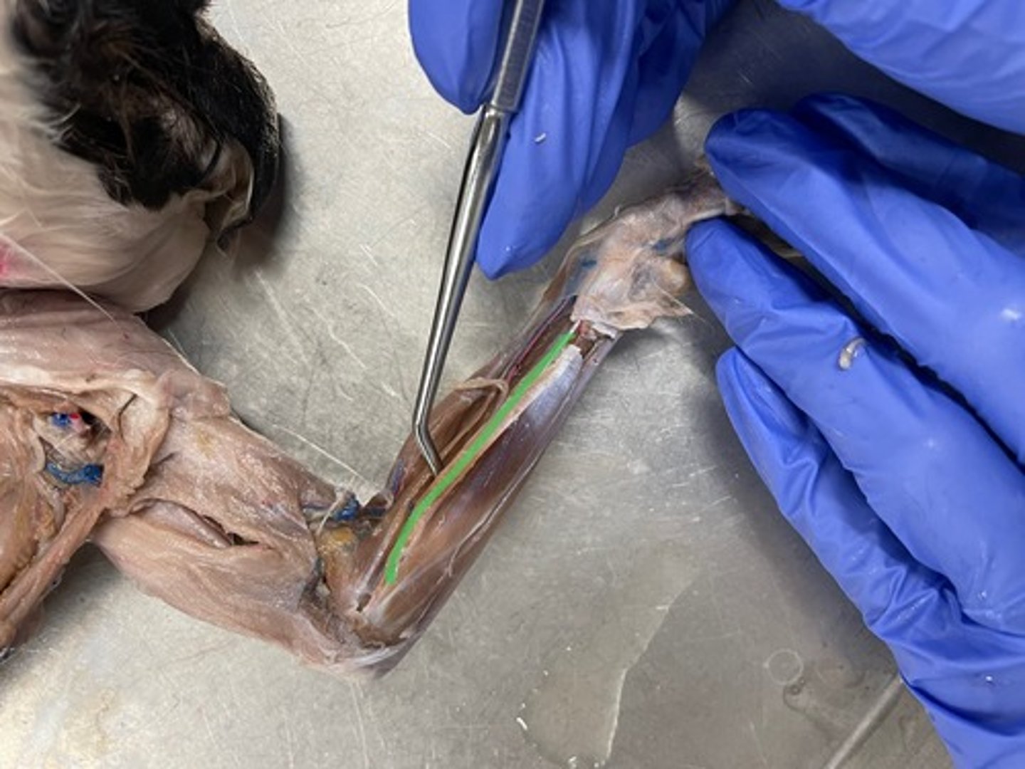 <p>O: medial epicondyle of humerus</p><p>I: base of metacarpals</p><p>A: flex wrist; abduct wrist</p>