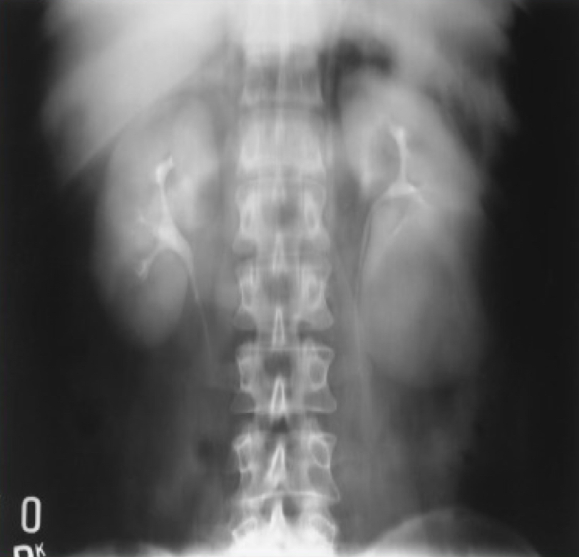 <p>What is this demonstrating?</p>