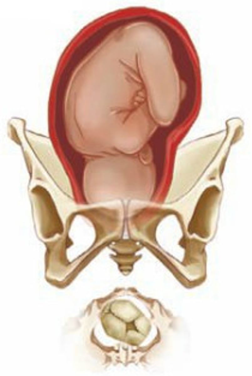 <p>In which quadrant of the mother's abdomen (anatomical position) would you place your stethoscope to listen to the FHR if the fetus presents in right occipitoanterior?</p>