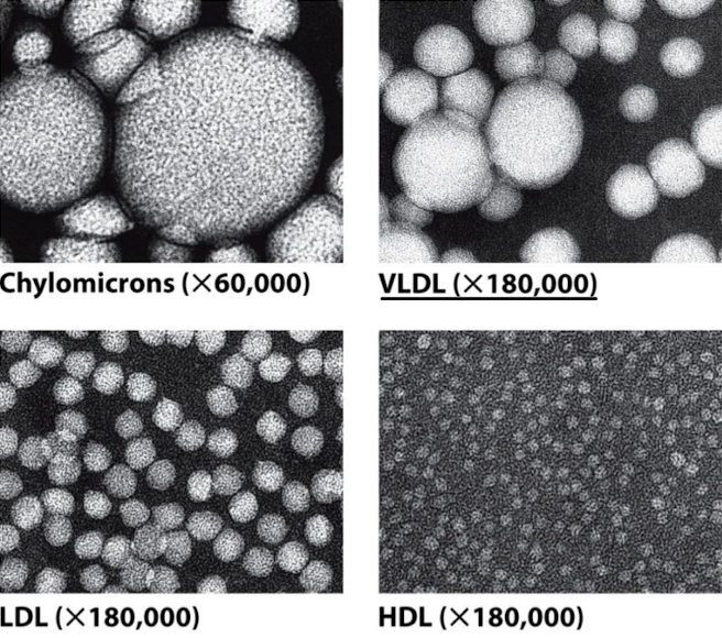 <p>The lower the density of a lipoprotein, the more lipid it contains relative to protein.</p>