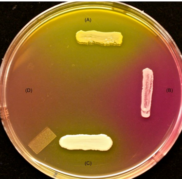 <p>The results in this image represent 4 different bacterial species inoculated onto an MSA plate. Which organism(s) is(are) halophilic and ferment mannitol?</p>