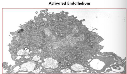 <p> oxidative stress, hypoxia, inflammation, infectious agents, and tissue injury</p>