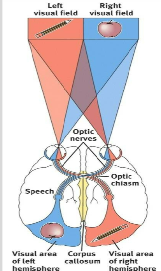 <p>With the corpus callosum severed, objects presented in the right visual field can be named while objects in the left cannot.</p>