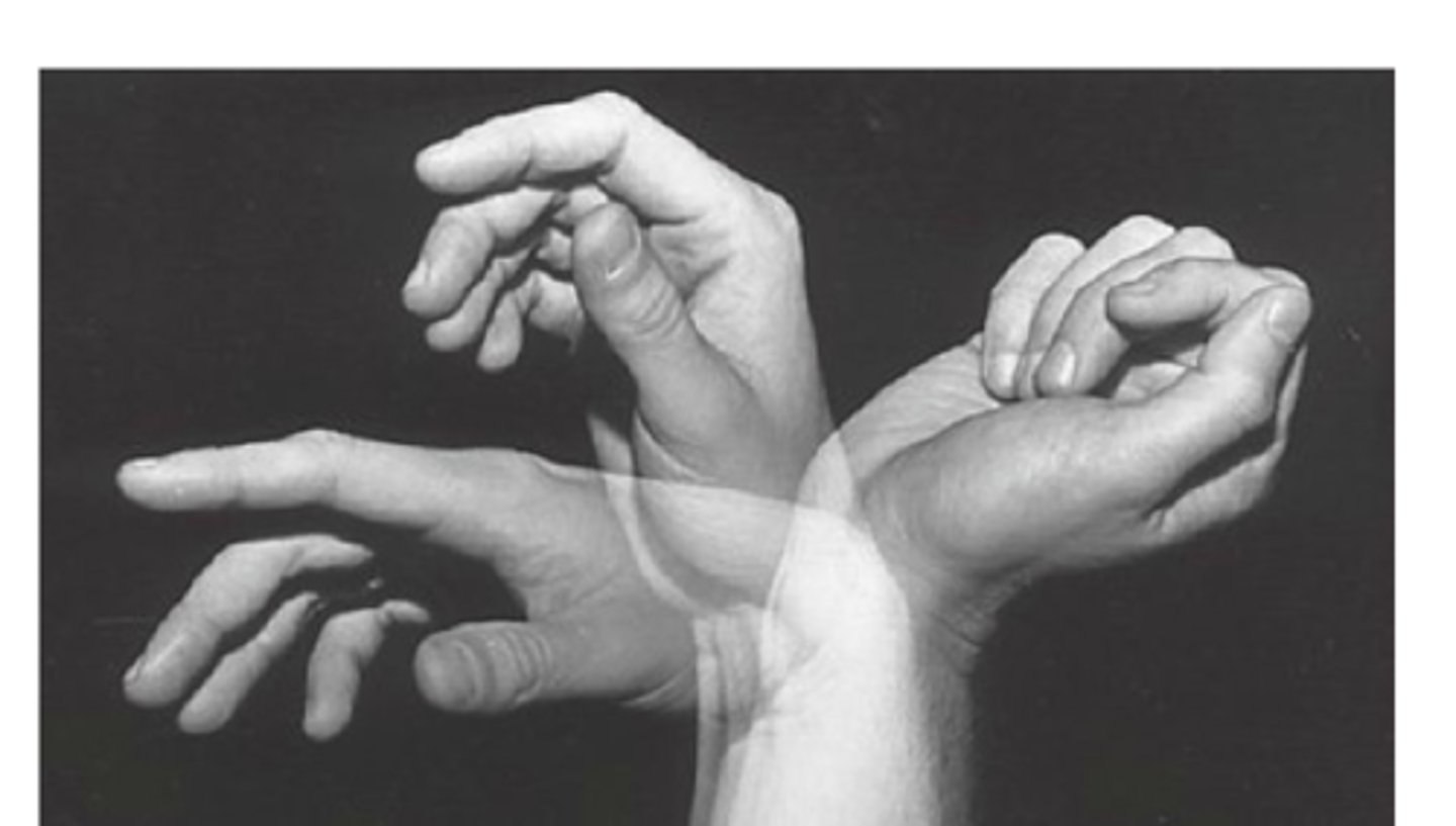 <p>1. What is happening in this picture?</p><p>2. What causes it?</p>
