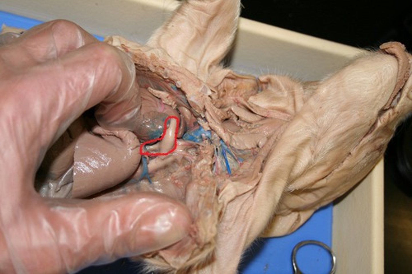 <p>Pulmonary artery</p>