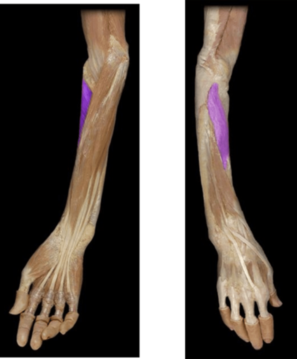 <p>What is the name of this muscle, highlighted in purple?</p>