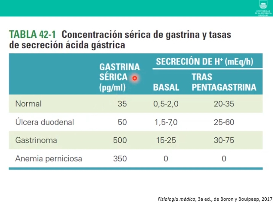 <ul><li><p><strong>Ulcera duodenal</strong>: respuesta inflamatoria x proliferacion de elicobacter pilori: aumentada la gastrina, aunentada la secrecion de acido basal y aumentada la secrecionde acido en respuesta a la estimulación. (favoreciendo el daño) problemas para liberar somatostatina. (Inhibir la secrecion de ácido no cura, alivia) Antibióticos contra el elicobacter pilori, cura.</p></li><li><p><strong>Gastrioma</strong>: tumor que produce gastrina, valores de gastrina muy aumentados, al igual que la secrecion de acido basal y muy aumentada la producción de acido.</p></li><li><p><strong>Anemia</strong> <strong>perniciosa</strong>: sin factor intrinseco x no tener celulas parietales, gastrina serica muy incrementada. NO produccion de ácido, ni a nivel basal ni a nivel estimulado x falta de celulas parietales que no producen factor intrinceco para absorcion de vitB12 ni ácido.</p><p></p></li></ul>