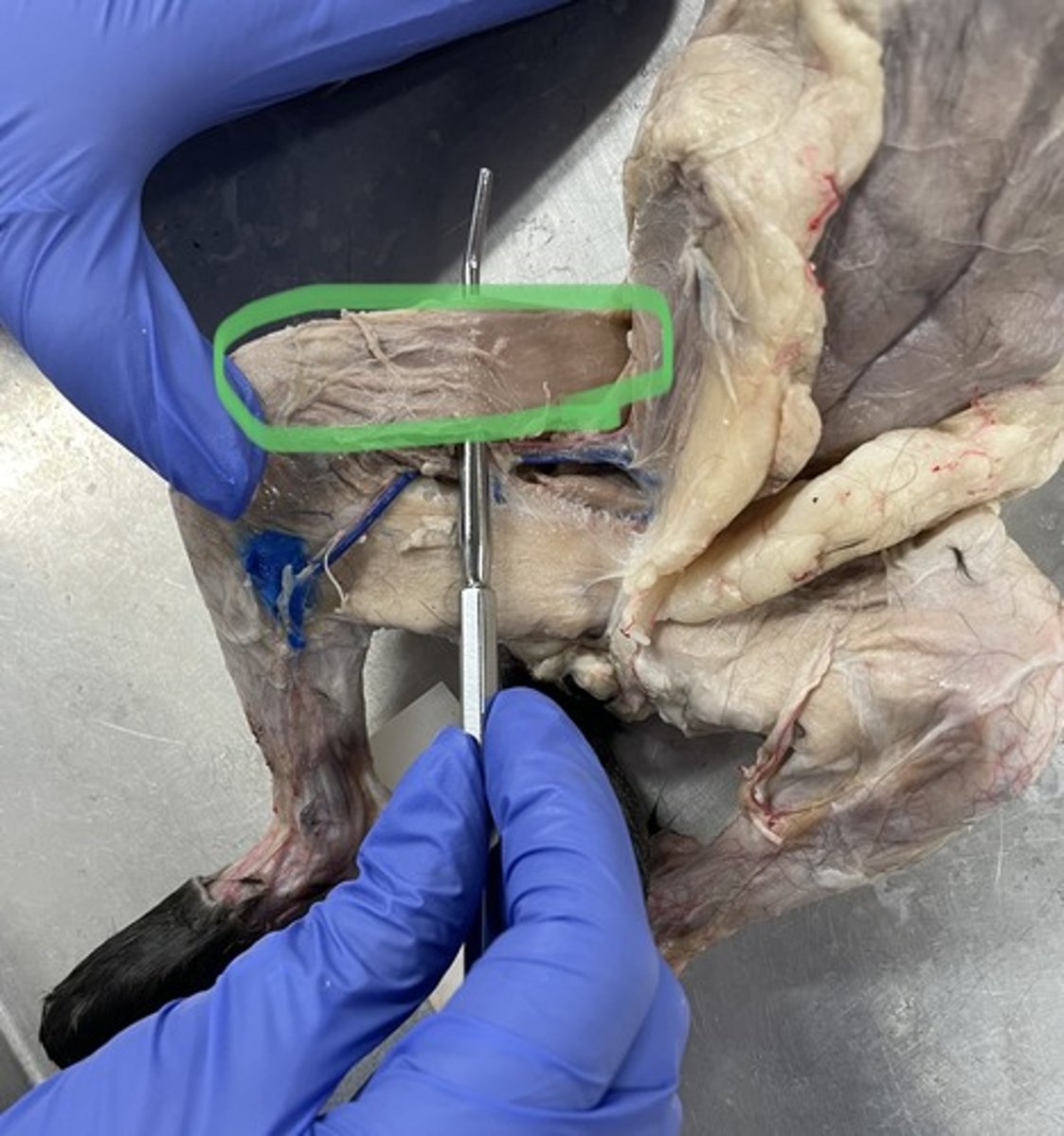 <p>O: anterior superior iliac spine of ilium</p><p>I: tibia</p><p>A: flex hip; laterally rotates hip</p>