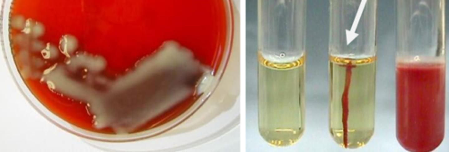 <p>Lactose fermentation</p><p>Vogues Proskauer positive</p><p>Nonmotile</p><p>Capsule</p><p>Ornithine-negative</p>