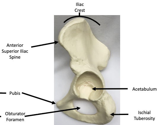 <p>What view of the Os Coxae is this?</p>