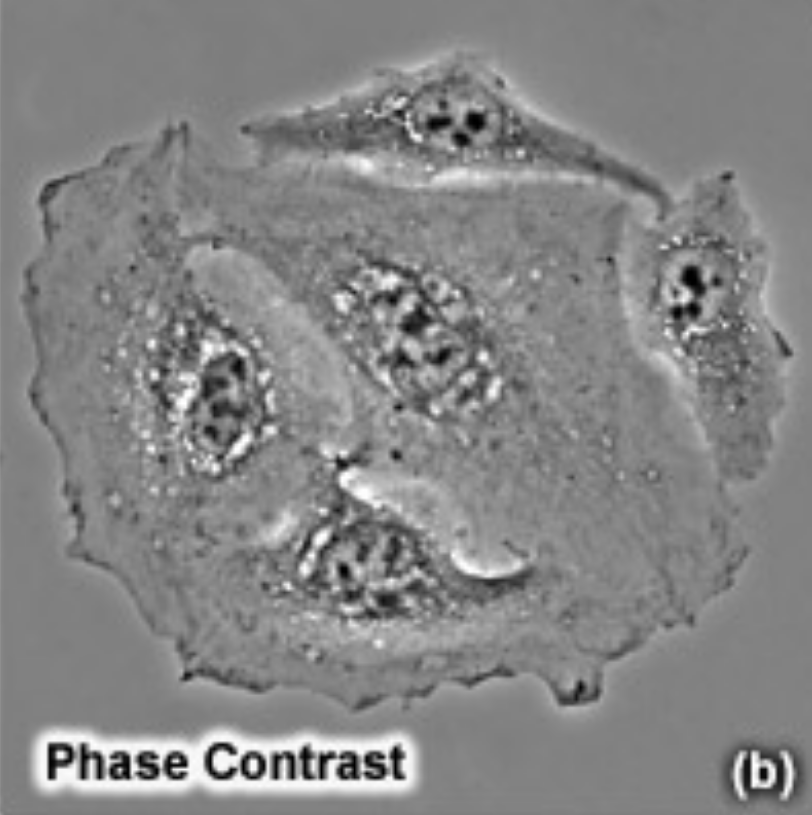 <p>Indirect light microscopy.</p><p>Capable of viewing living specimens by using visible light and optical lenses to magnify an image.</p><p>Two complimentary out-of-phase light filters can be affixed to the microscope to provide significant specimen contrast, eliminating the need for staining or fixation. The first filter only allows perimeter light to pass through, whilst the second filter blocks perimeter light. As a result, only indirectly refracted perimeter light can illuminate the specimen, resulting in enhanced edge contrast.</p><p>Haloes for phase contrast due to edge lighting</p>