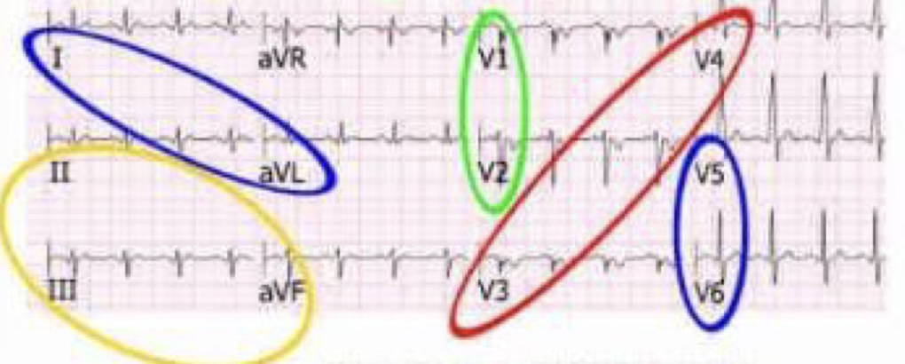 <p>What do the colors mean within the diagram?</p>