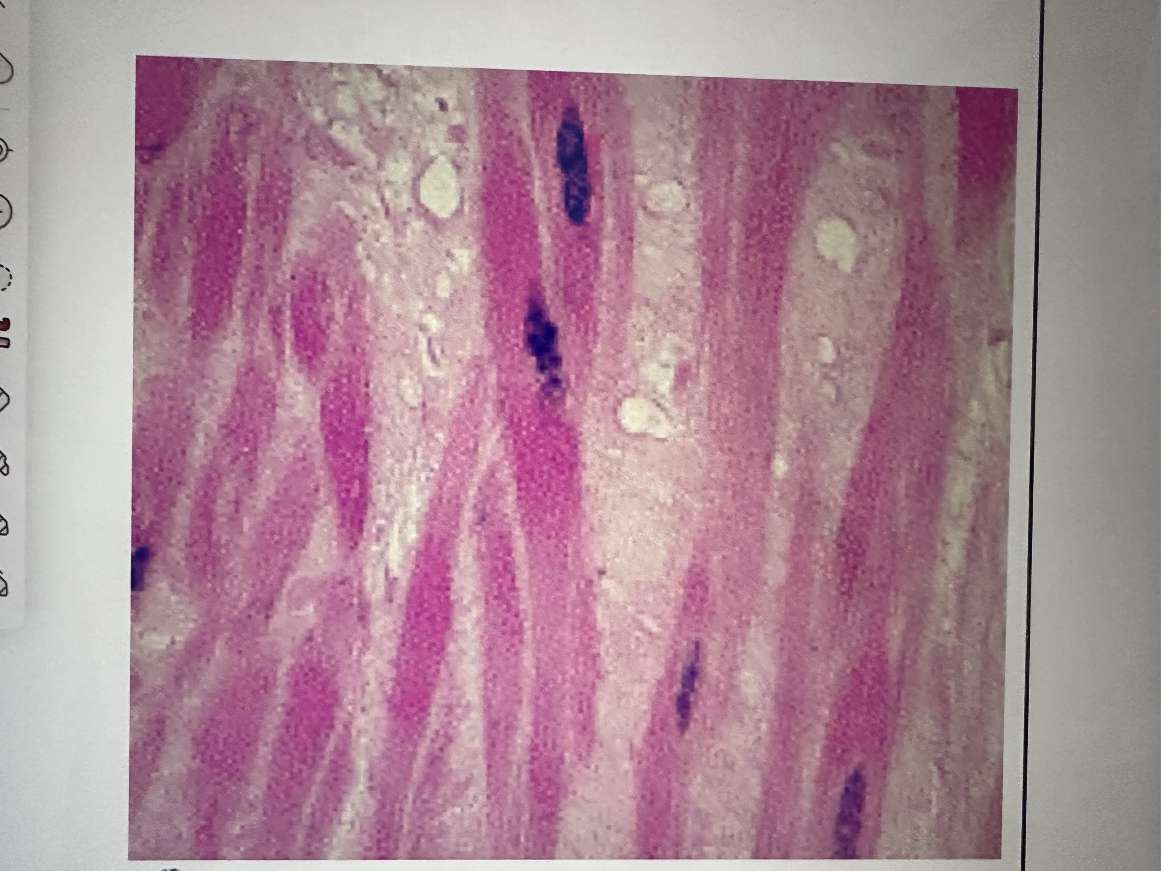 <p>Involuntary, no striated, single nucleus, spindle shape , shrter than skeletal, FOUND IN THE WALLS OF INTERNAL ORGANS</p>