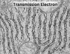 <ul><li><p>Electron beam passes through a very thin section of sample </p></li><li><p>Produces a high magnification 2D image </p></li><li><p>Uses </p><ul><li><p>Allows for high resolution viewing of internal structures </p></li><li><p>Ideal for viewing internal structure of cells, tissues, and organelles </p></li><li><p>High magnification </p></li></ul></li><li><p>Disadvantages </p><ul><li><p>Kills cells </p></li></ul></li></ul><p></p>