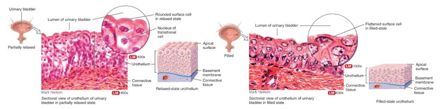 <p>several layers of cells that all vary in shape; capable of stretching and permits distention of an organ, lines most of urinary tract</p>