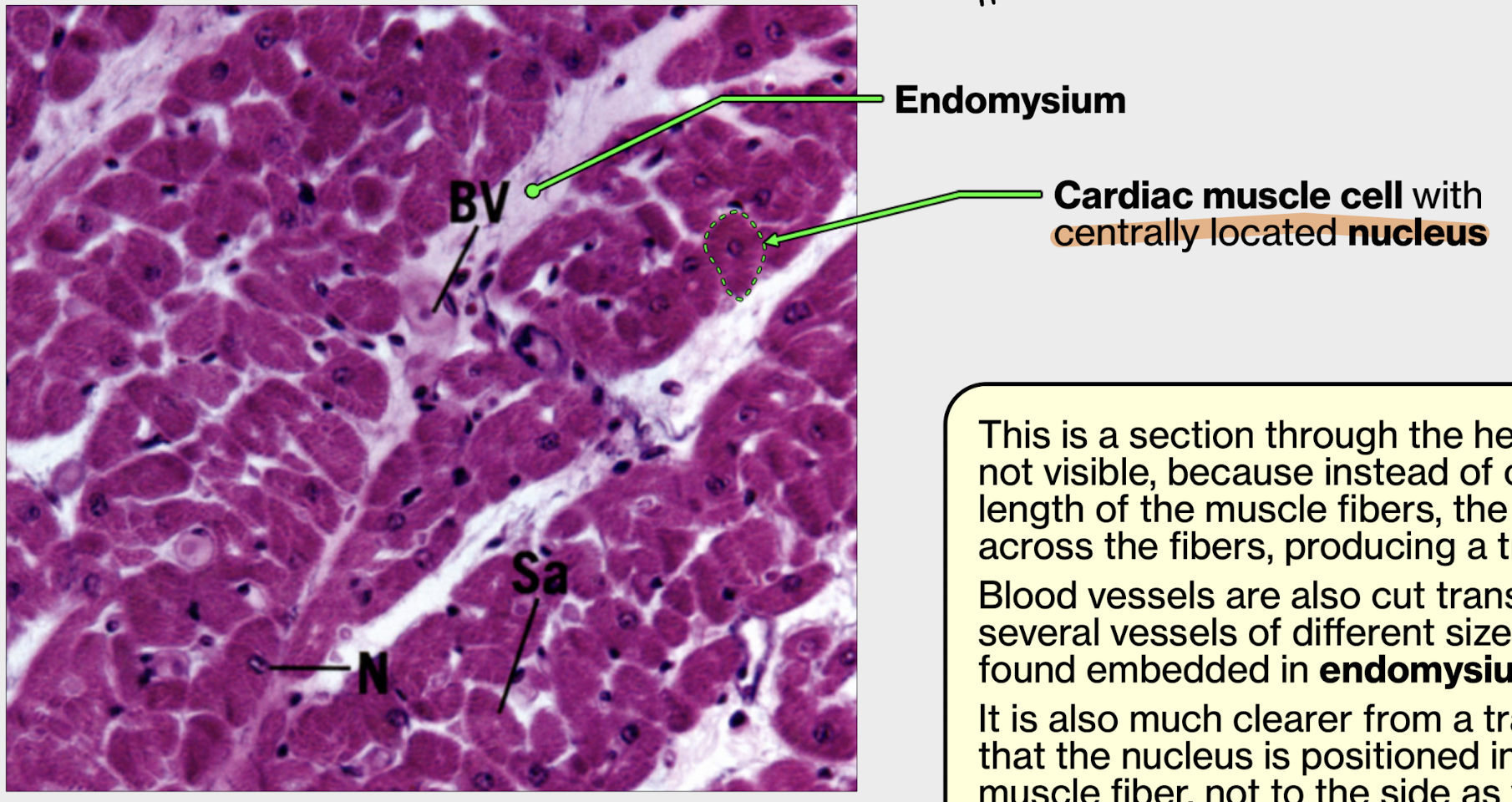 <p>cardiac muscle cell transverse section </p><p>notice the blood vessel found embedded in endomysium </p><p>nucleus of cell found in the middle — opposite of skeletal muscle </p>