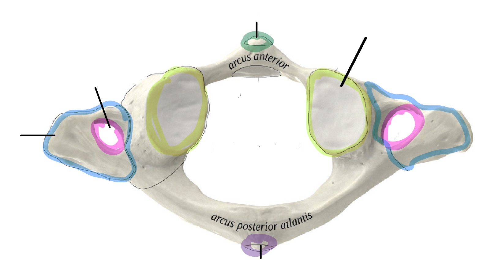 <p>Which vertebrae is this </p>