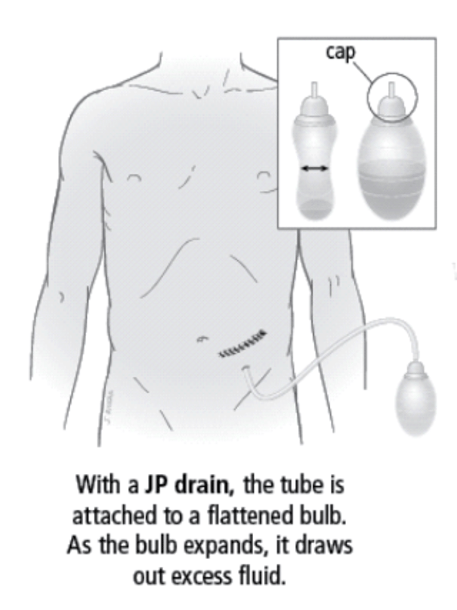 <p>Jackson-Pratt (JP) drains are ________________________ drains so they do not need to be placed below the level of the wound. Good for internal hematomas and _______________________.</p>