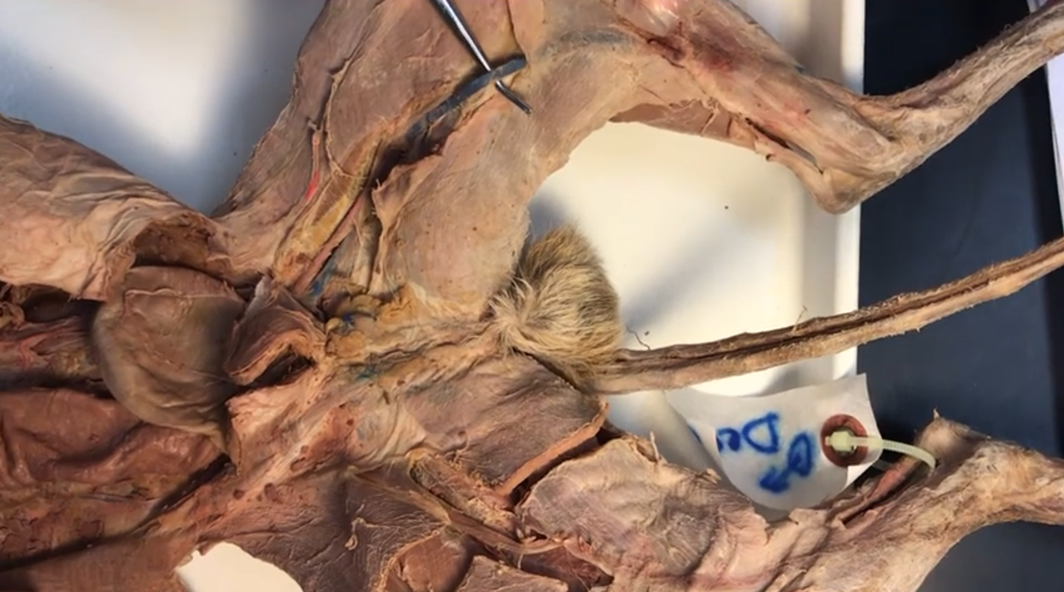 <p>What vein is this</p>