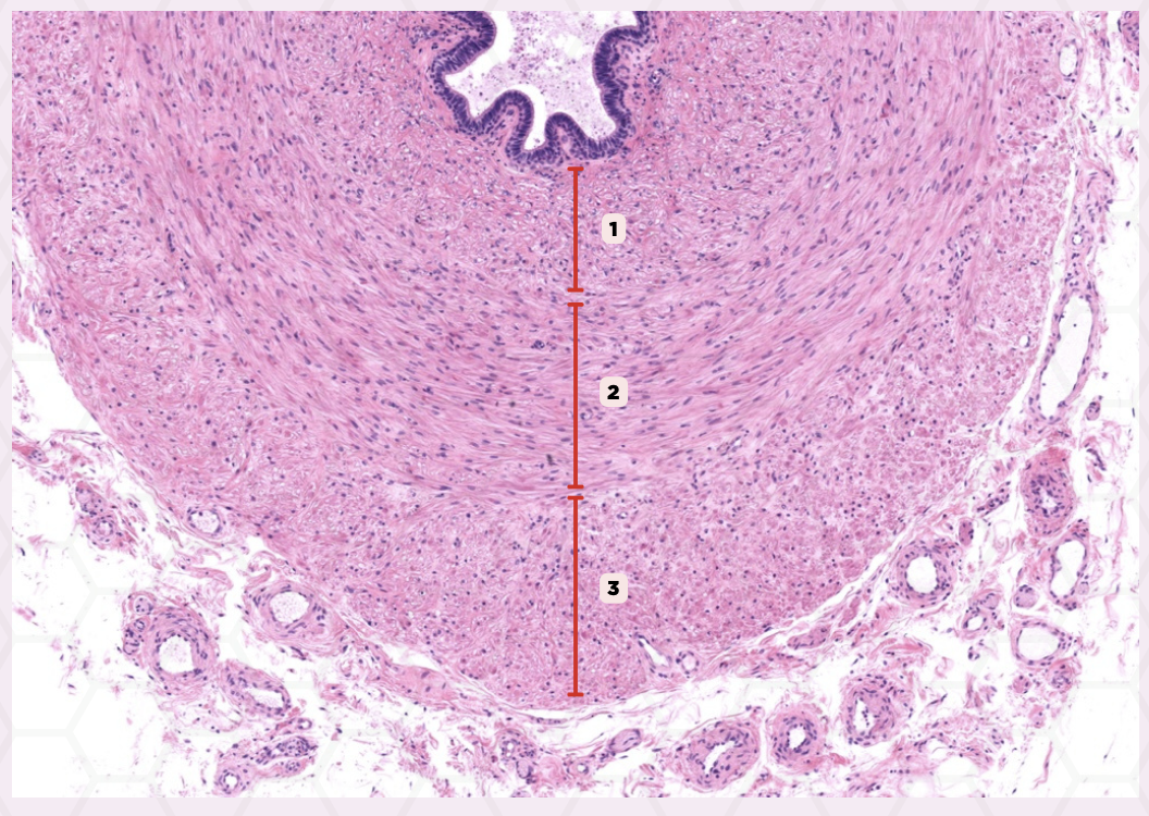 <p>Identify the structure labeled as 3.</p>