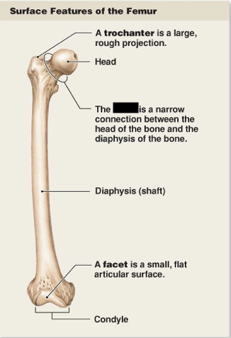 <p>this is the main surface features of the femur, what is this?</p>