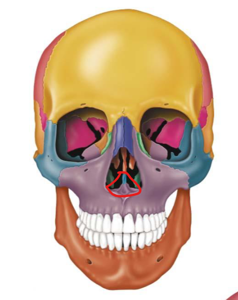 term image