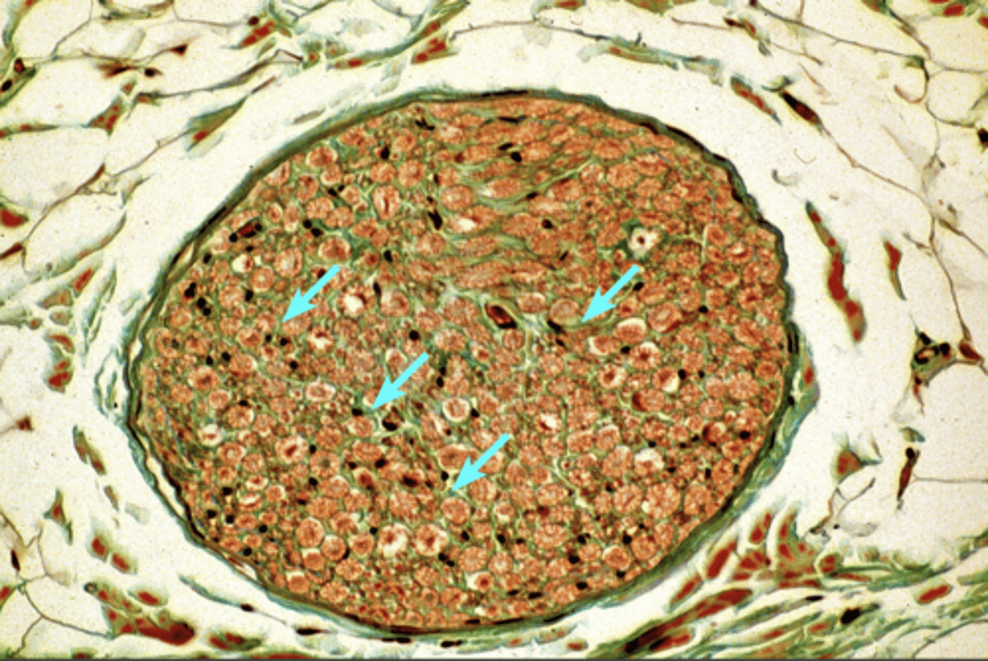 <p>innermost layer containing the schwann cells myelinating individual nerve fibers</p>