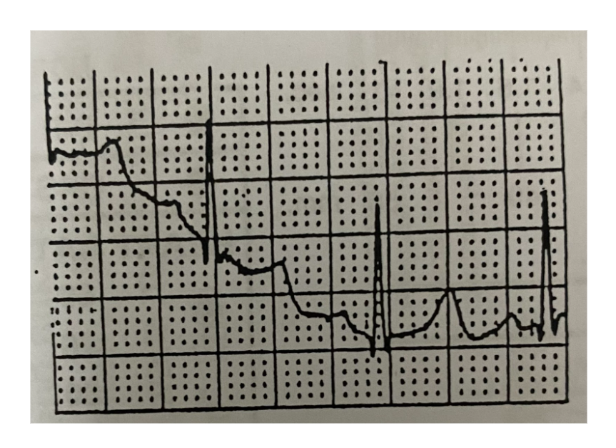 <p>What does this mean?</p>