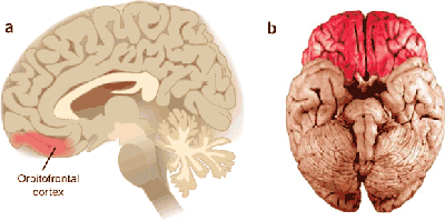 <p>with damage show: behavioral and emotional disinhibition, rarely emotional neutral, cannot inhibit urge for instant gratification, no foresight for consequences, antisocial, criminal behavior</p>