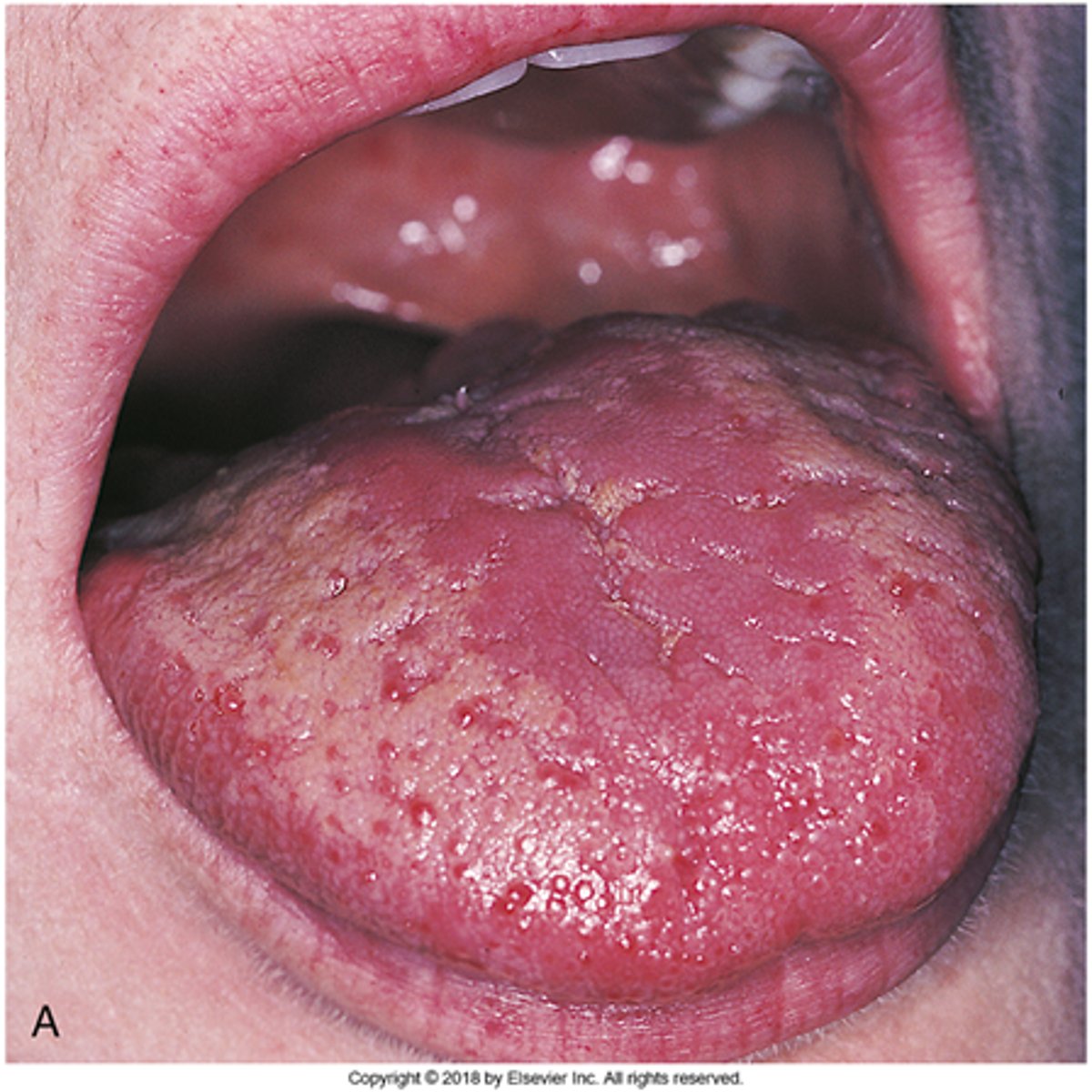 knowt flashcard image