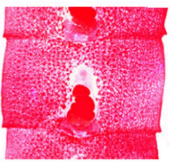 <p><span>Proglottids:</span><br><span>– broader than long</span><br><span>– central, rosette</span><br><span>shaped</span><br><span>– genital pore, middle</span><br><span>of flat surface</span></p>