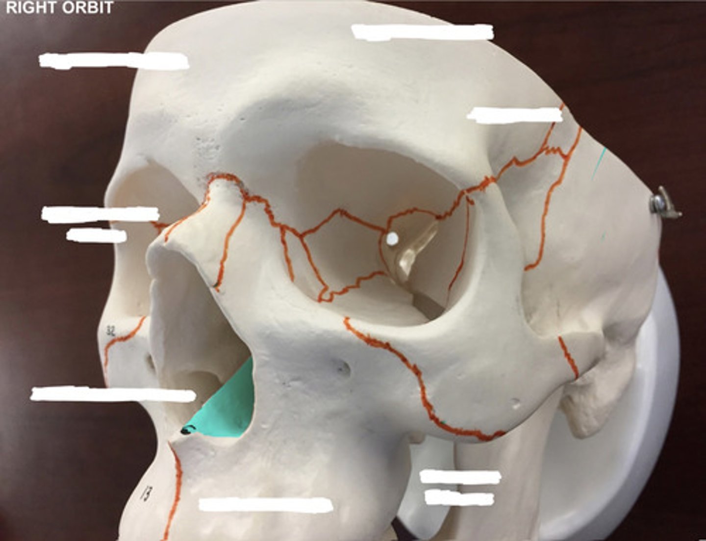 <p>What bone is highlighted here?</p>