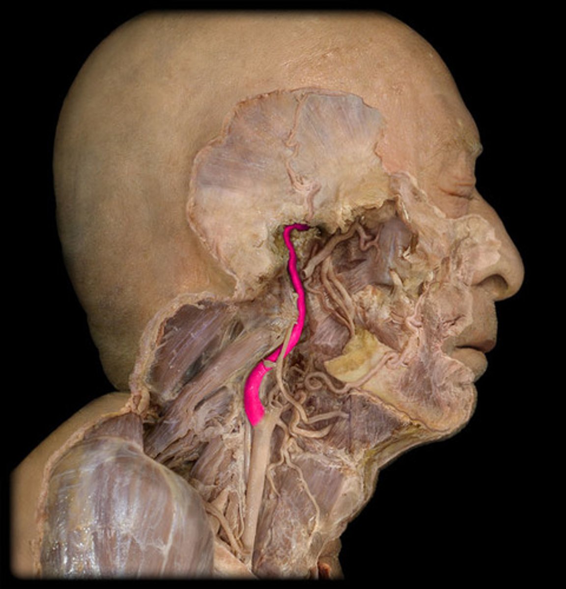<p>Name the Artery</p>