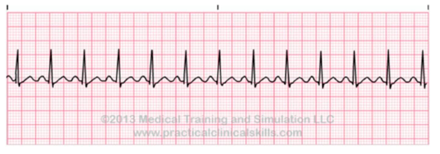 <p>number of times heart beats in one minute</p>
