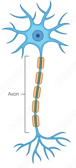 <p>What is the classification of this neurone?</p>