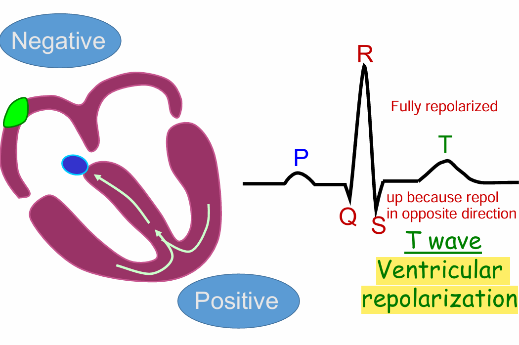 <p>Full Ventricular repolarization</p><p>Upwards because in opposite direction </p>