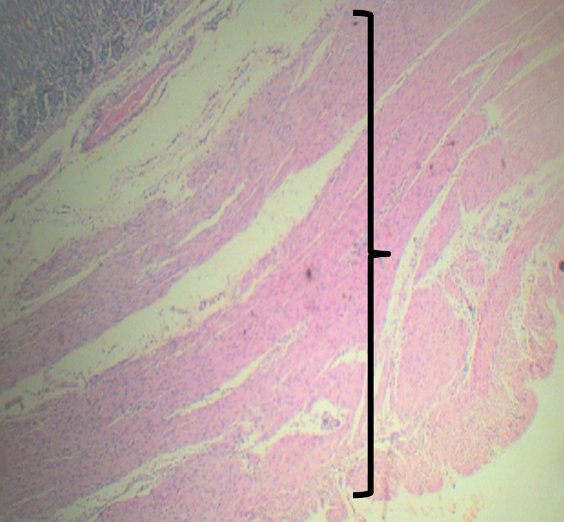 <p><span>Smooth muscle arranged in 3 LAYERS:</span></p><p><span>1. Outer Longitudinal</span></p><p><span>2. Middle Circular</span></p><p><span>3. Inner Oblique</span></p>